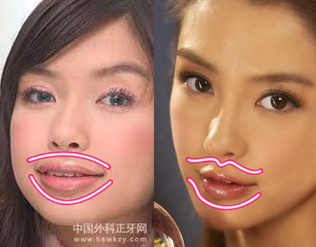 Celebrity Before and After Plastic Surgery Angelababy