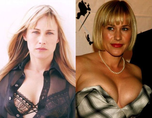 Patricia Arquette Boob 69