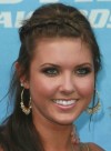 Audrina Patridge after plastic surgery