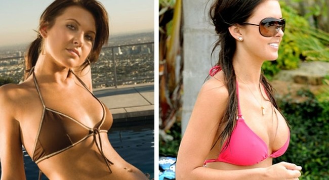 Audrina Patridge before and after boob job