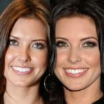 Audrina Patridge before and after chin surgery and lip implants