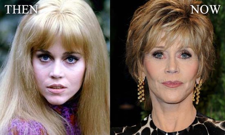 Jane Fonda's plastic surgery; behind the scenes of her exquisite look