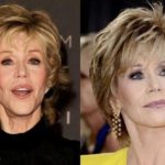 Jane Fonda before and after plastic surgery