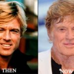 Robert Redford before after plastic surgery