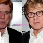 Robert Redford plastic surgery before and after