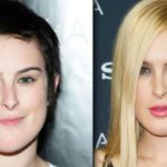 Rumer Willis before and after plastic surgery 150x150