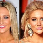 Stephanie Pratt before and after pictures