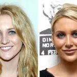 Stephanie Pratt before and after plastic surgery