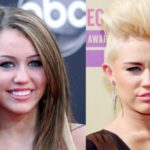 Miley Cyrus before and after nose job