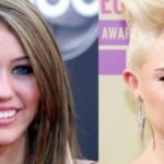 Miley Cyrus before and after nose job plastic surgery