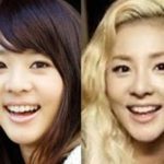 Sandara Park 2ne1 nose job plastic surgery