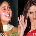 Kareena Kapoor Plastic Surgery Before and After