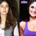 Kareena_Kapoor_Plastic_Surgery