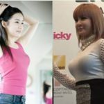 Park Bom before and after breast implants plastic surgery