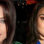 Preity Zinta before and after nose job plastic surgery 150x150