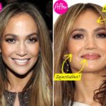 jennifer lopez plastic surgery rumors