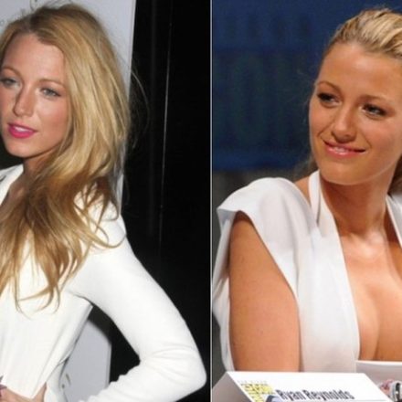 Blake Lively before and after boob job surgery 150x150.