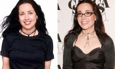 Are the Public Opinions About Janeane Garofalo Plastic Surgery Correct?