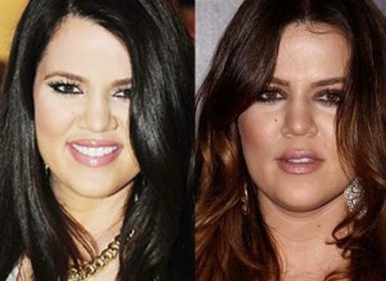 Khloe Kardashian before and after