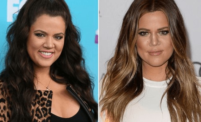 Khloe kardashian before and after alleged nose job plastic surgery