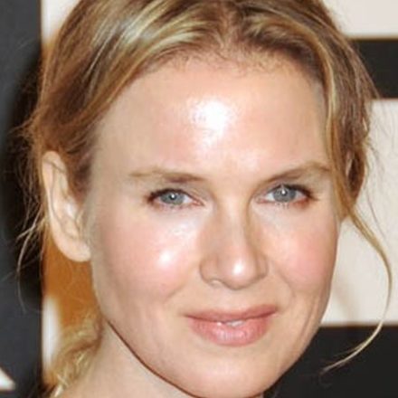 What Experts And Others Have to Say About Renee Zellweger Plastic Surgery?