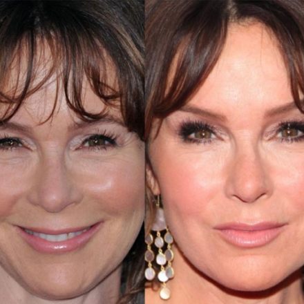 Jennifer Grey Plastic Surgery Mishap