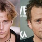 Sean Patrick Flanery Plastic Surgery Before and After