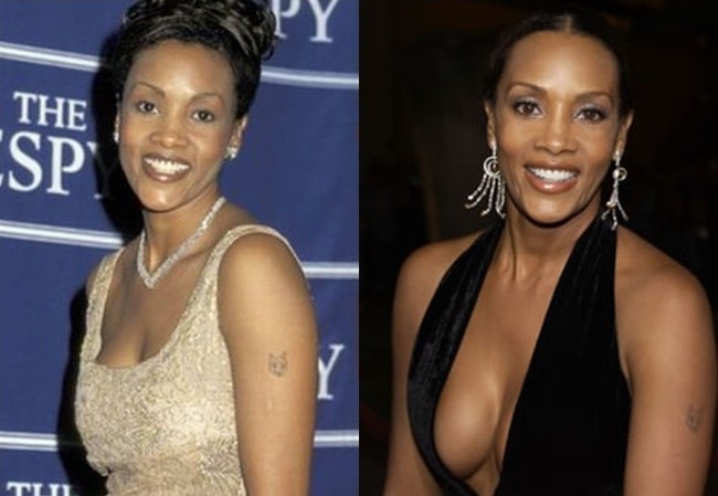 Vivica Fox Plastic Surgery Indication