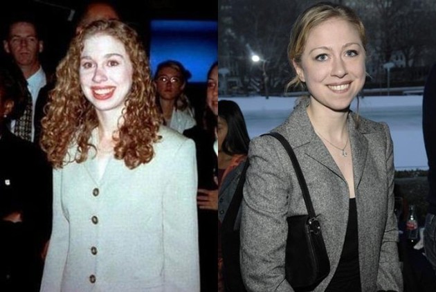 Chelsea Clinton Has Done Very Successful Plastic Surgery