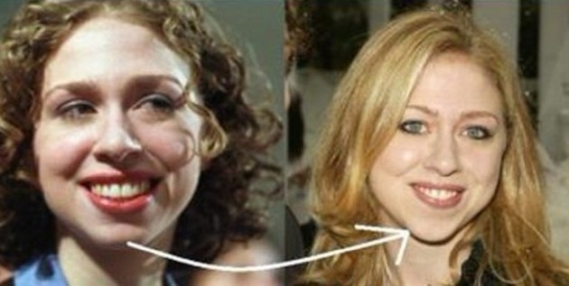 Chelsea Clinton Has Done Very Successful Plastic Surgery