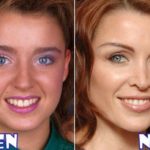 Danii Minogue Before And After Photos
