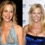 Julie Benz Before And After Plastic Surgery Boob Job