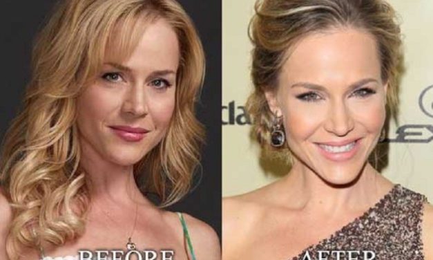 Julie Benz Plastic Surgery That Made Her Look More Beautiful