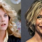 Meg Ryan Before And After Plastic Surgery