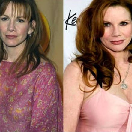 Inside Information On Melissa Gilbert Plastic Surgery