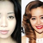 Michelle Phan Before And After Plastic Surgery