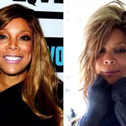 The Whole Truth About Wendy William Plastic Surgery
