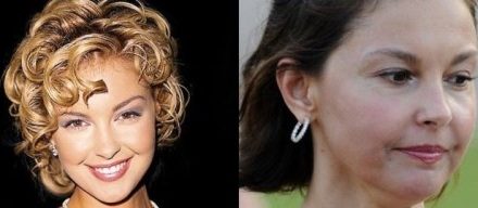 Ashley Judd’s Face Changes Due To Botox Injections?