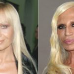 Donatella Versace plastic surgery gone bad