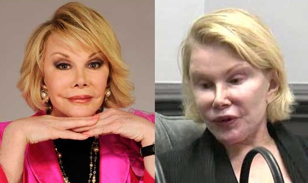 ugly plastic surgeryimage