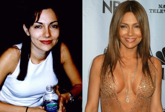 vanessa marcil plastic surgery