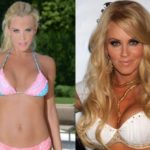 Jenny McCarthy Before And After Plastic Surgery