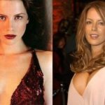 Kate Beckinsale Before And After Plastic Surgery