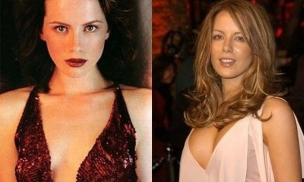 Kate Beckinsale: Plastic Surgery Done Right