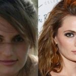 Stana Katic Before And After Nose Job