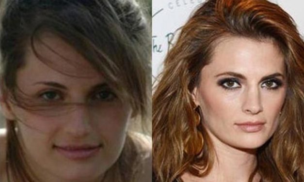 Other Than Nose Job, Has Stana Katic Done Something Else?