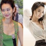 Shin Min Ah Before And After Plastic Surgery