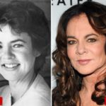 Stockard Channing Before And After Eye Lift