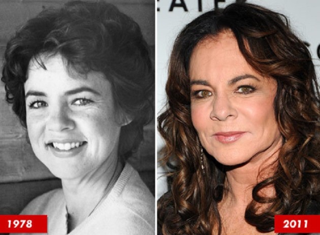 Rumors About Stockard Channing Plastic Surgery Procedure