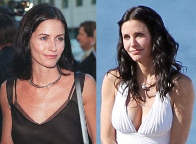 Courteney Cox Plastic Surgery Speculations Have Been Confirmed